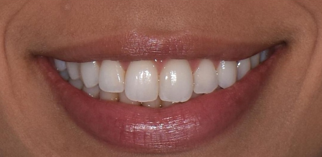 After treatment 5