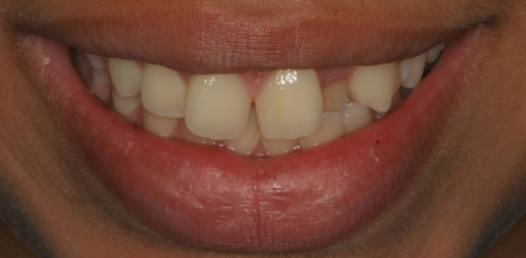Before treatment 5