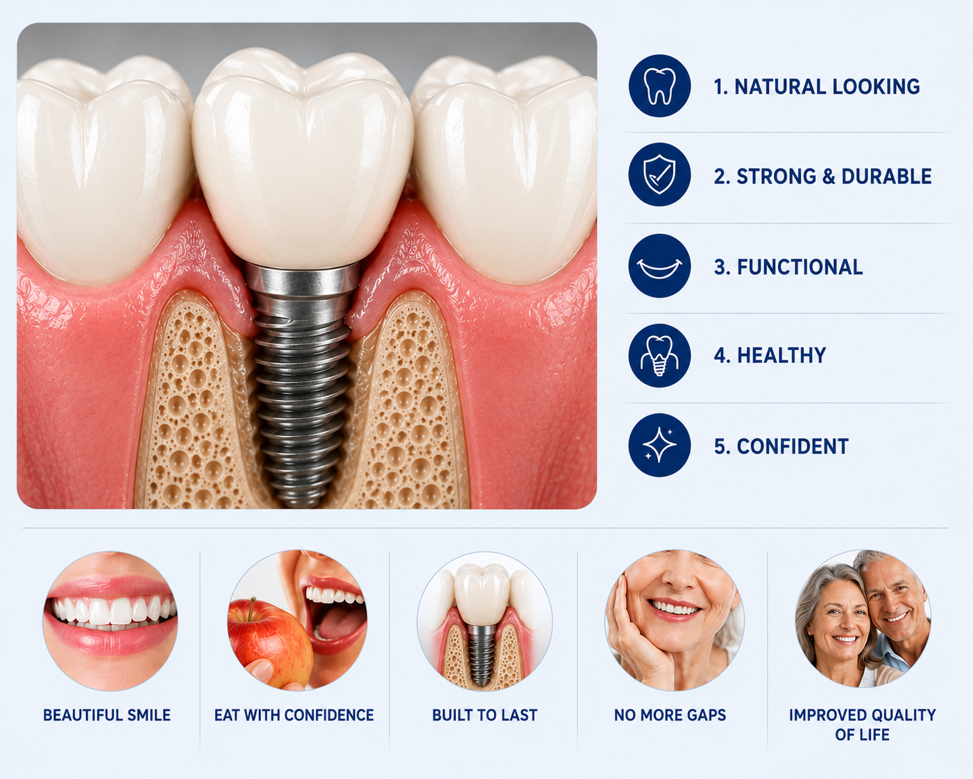 Final implant restoration