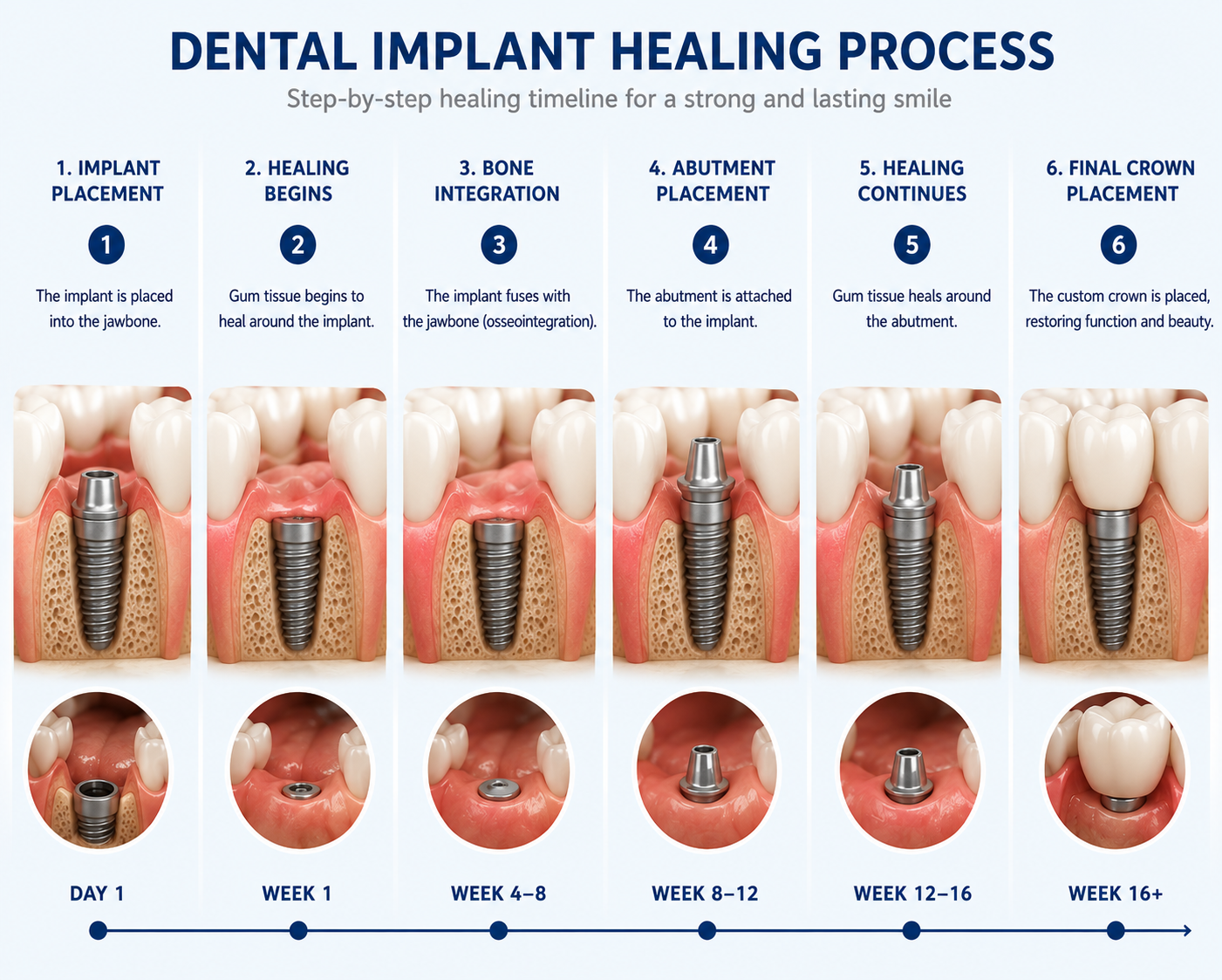 Dental implant healing process